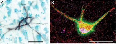 Sleep and Memory Consolidation Dysfunction in Psychiatric Disorders: Evidence for the Involvement of Extracellular Matrix Molecules